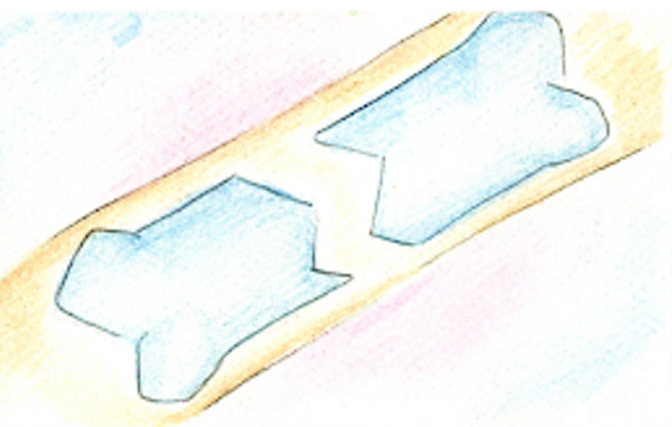 What is a broken bone