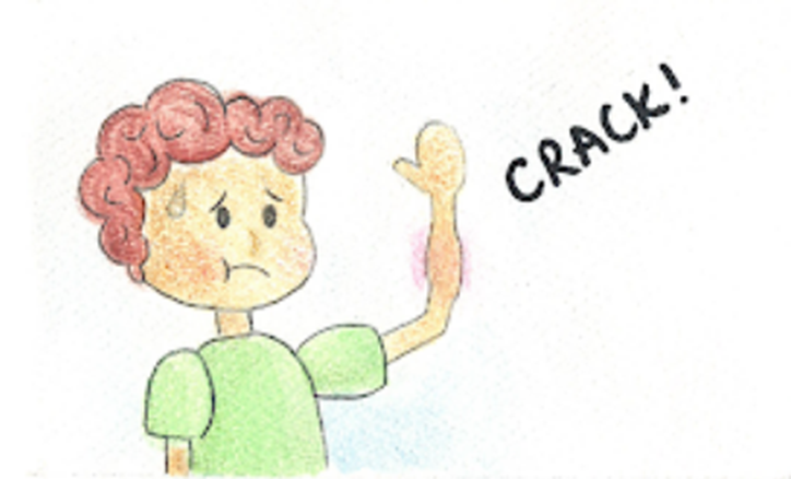 How bones break from falling or getting hit