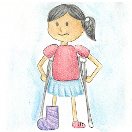 Getting a cast and using crutches